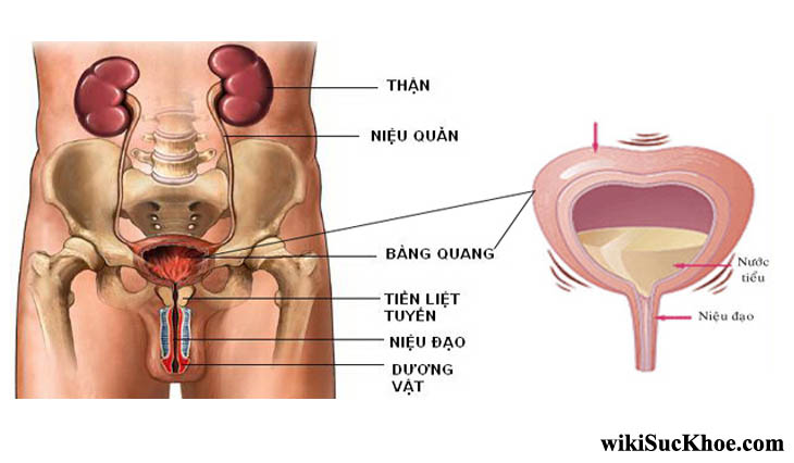 Bệnh viêm bàng quang là bệnh gì?
